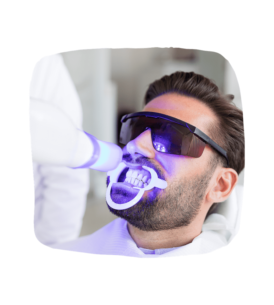 Tratamiento de Blanqueamiento Dental