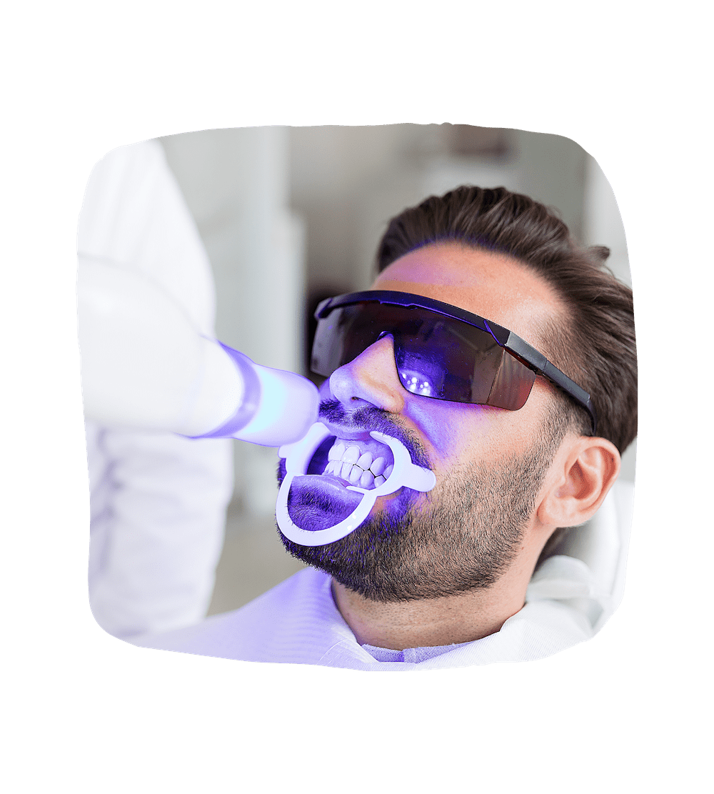 Teeth Whitening Treatment