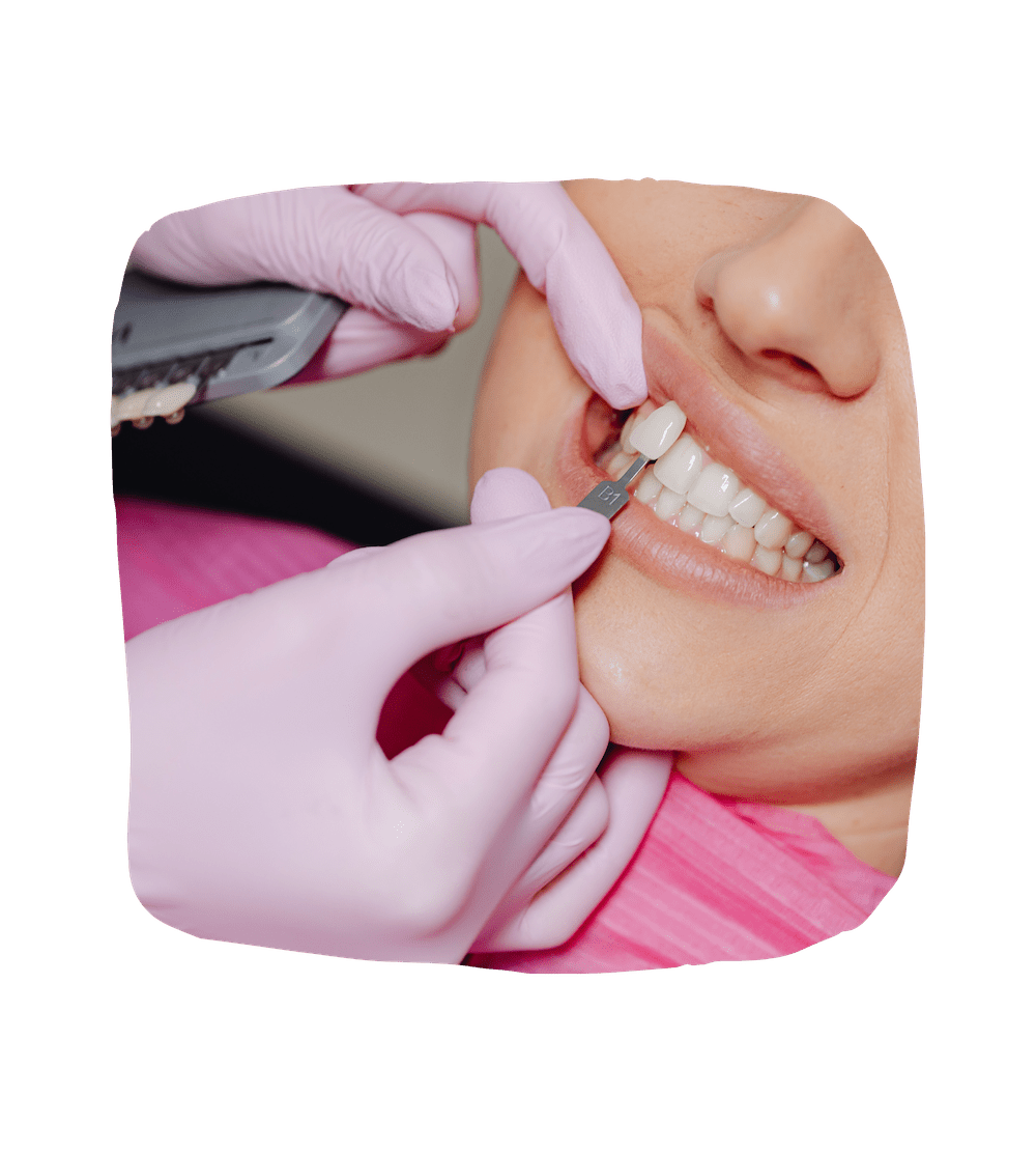 Dental Veneers Dental Faith Dentistry Nasvhille