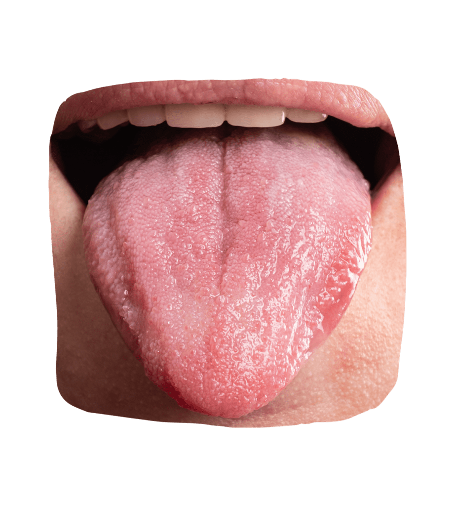 Detección de Cáncer Oral