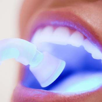 teeth whitening blog