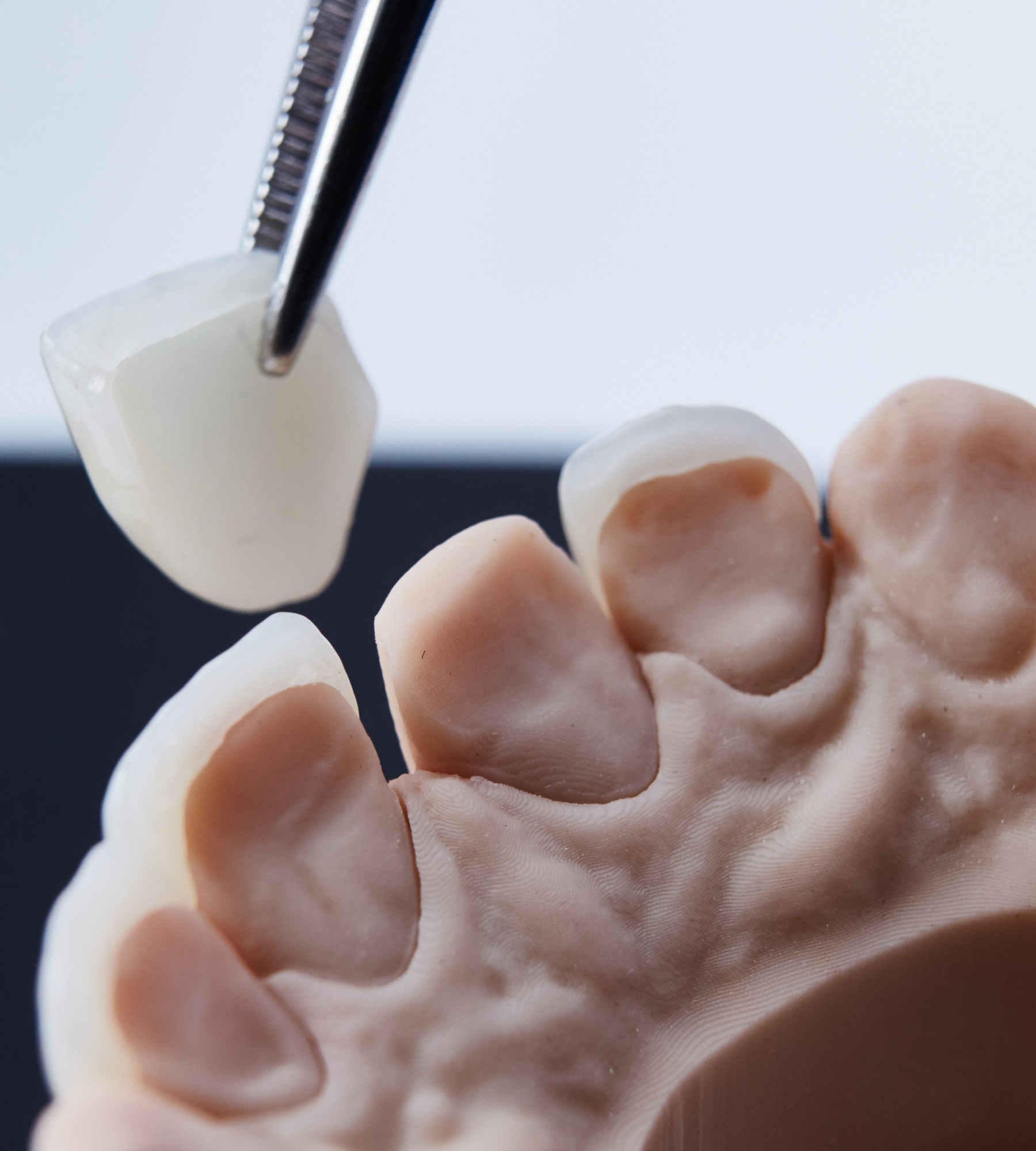 everything to know about same day dental crowns