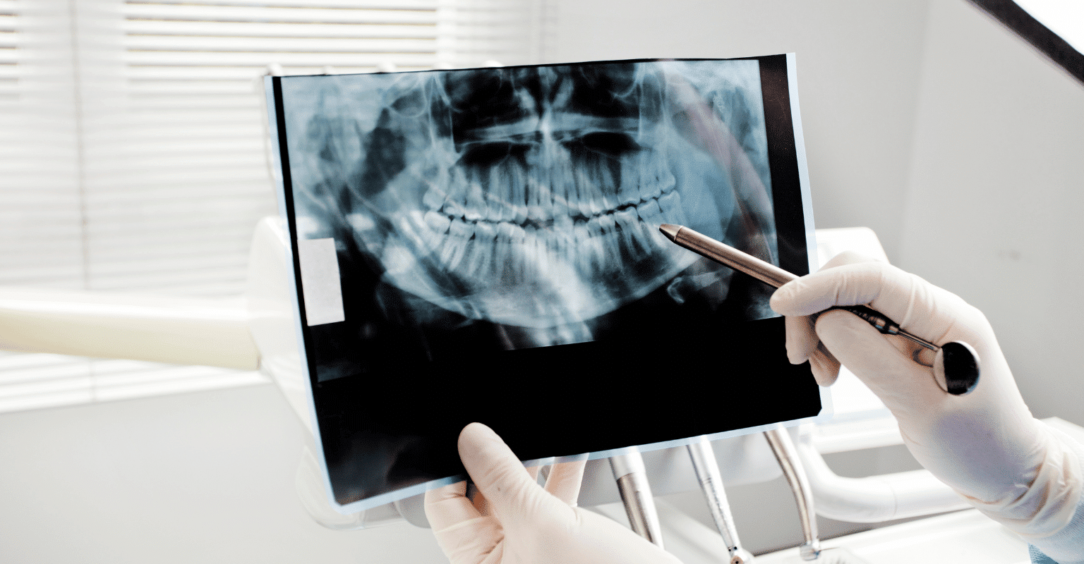 digital dental x-rays