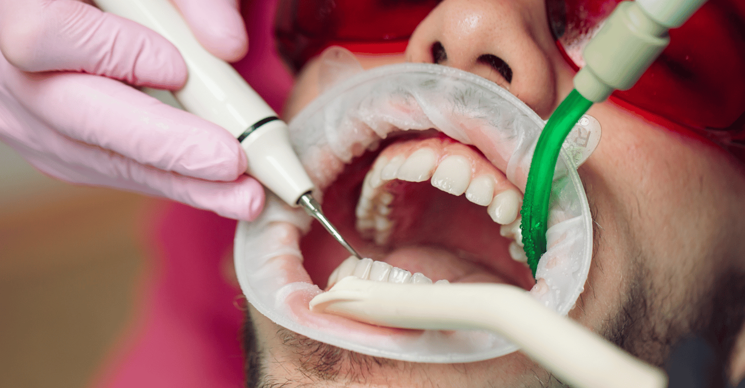 heal cracked teeth naturally