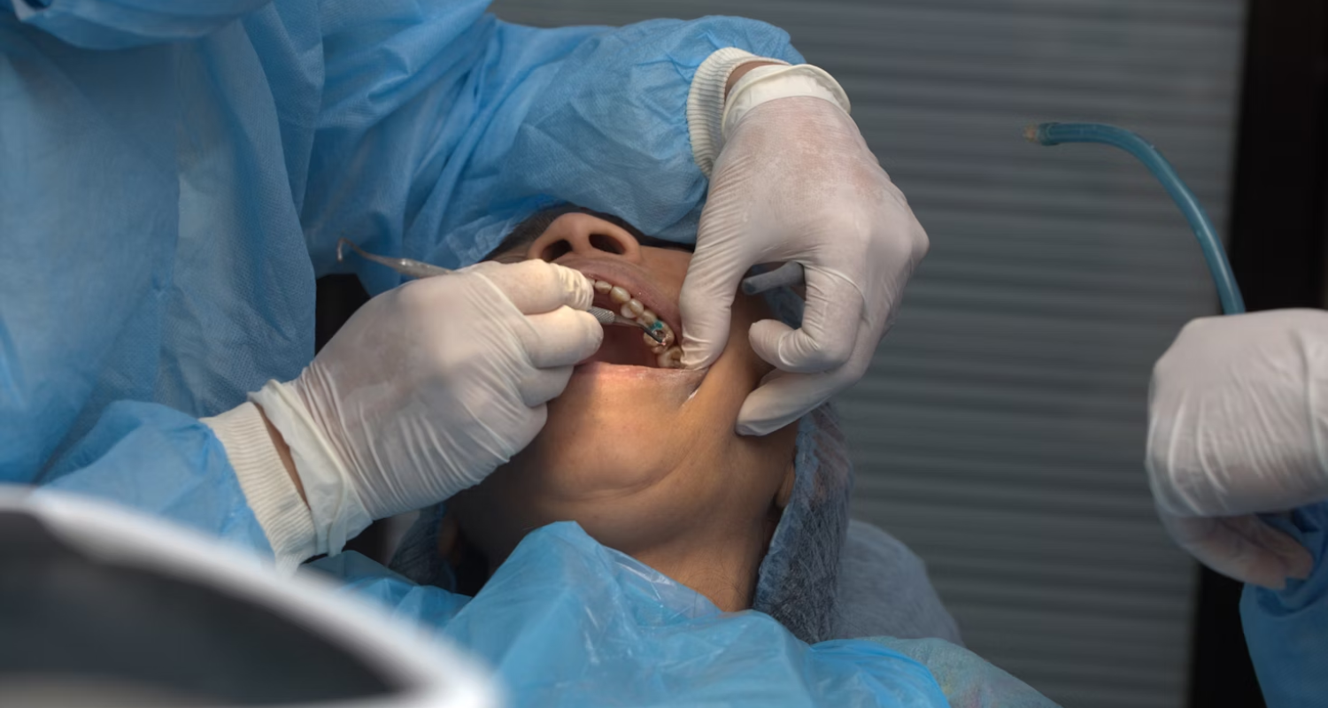 wisdom teeth removal cost without insurance