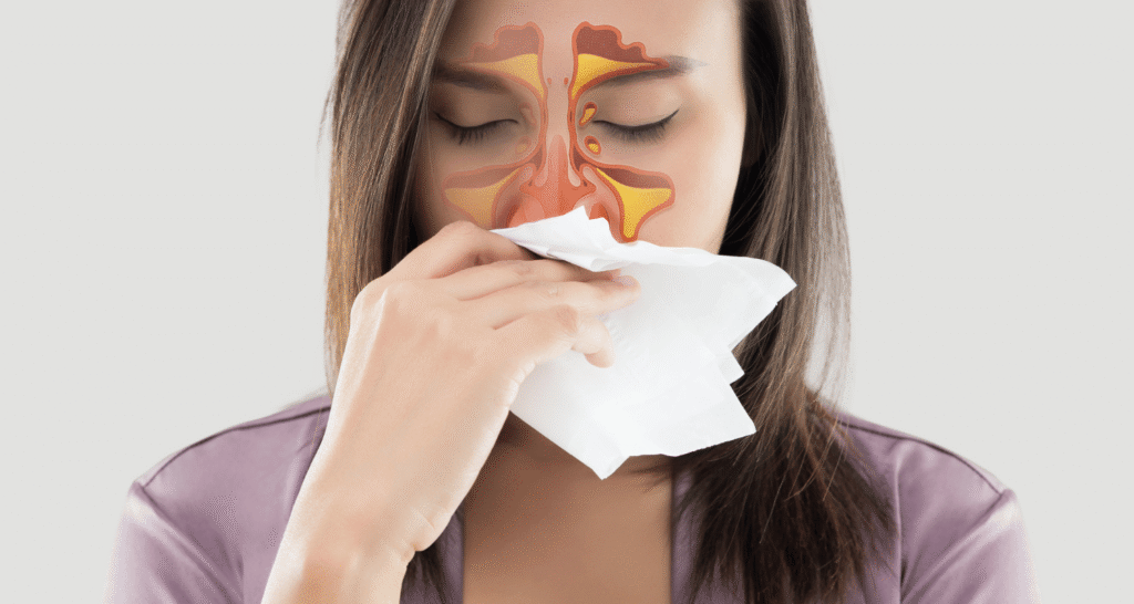 Can Sinus Cause Toothache Pain?
