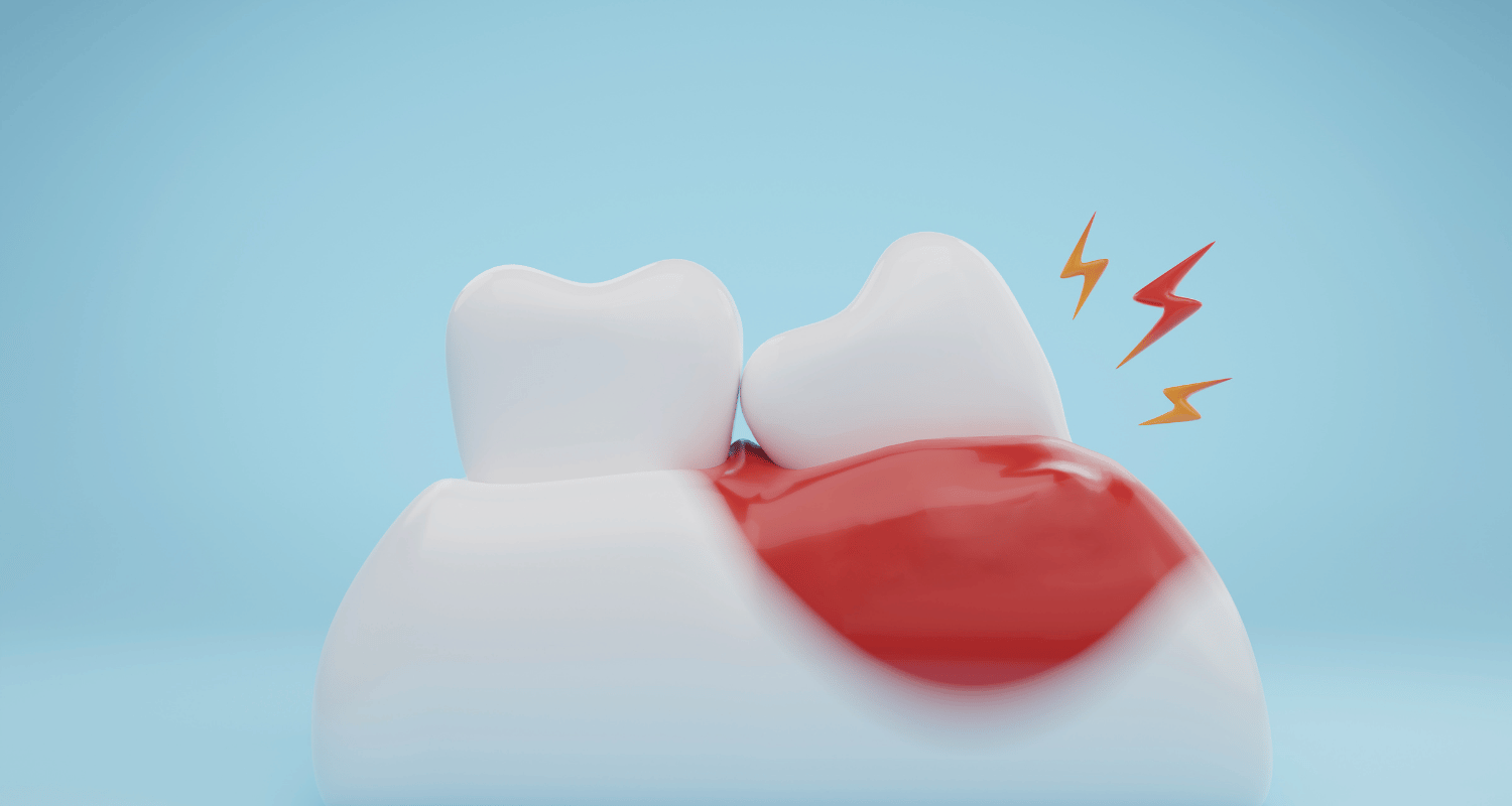 Can Sinus Cause Toothache Pain?