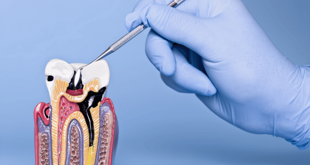How long can you keep your teeth with periodontal disease