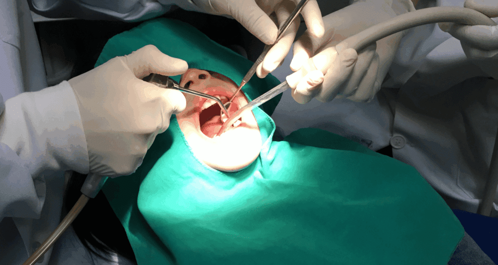 Endodoncista vs. Cirujano Oral
