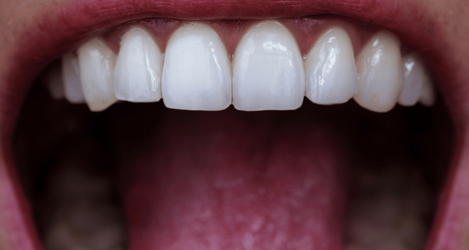 Benefits of Straight Teeth