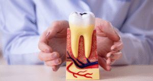 How Often Should You Go to the Dentist for Cleaning