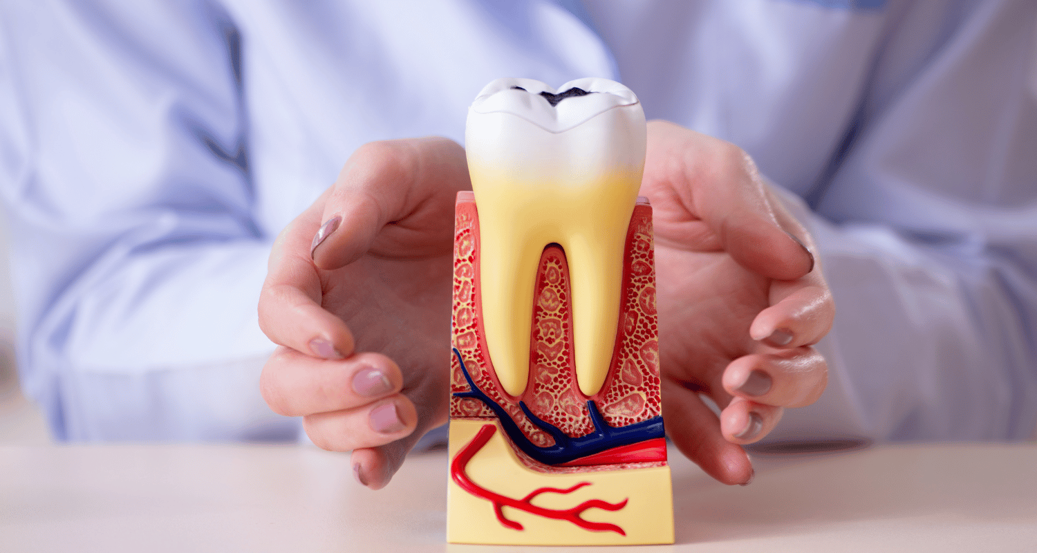 How Often Should You Go to the Dentist for Cleaning