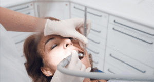dental fillings