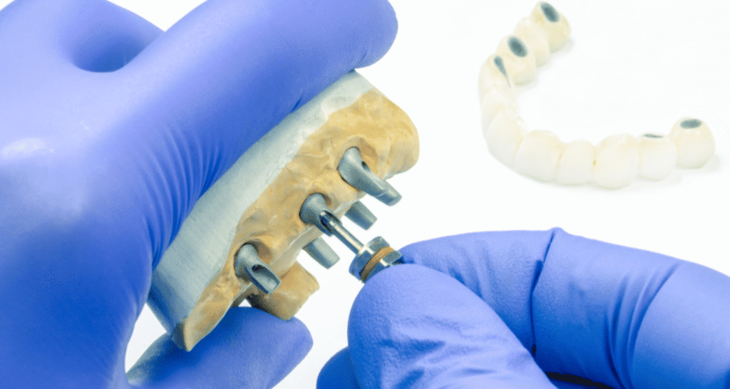 What kind of dentist does implants and dentures