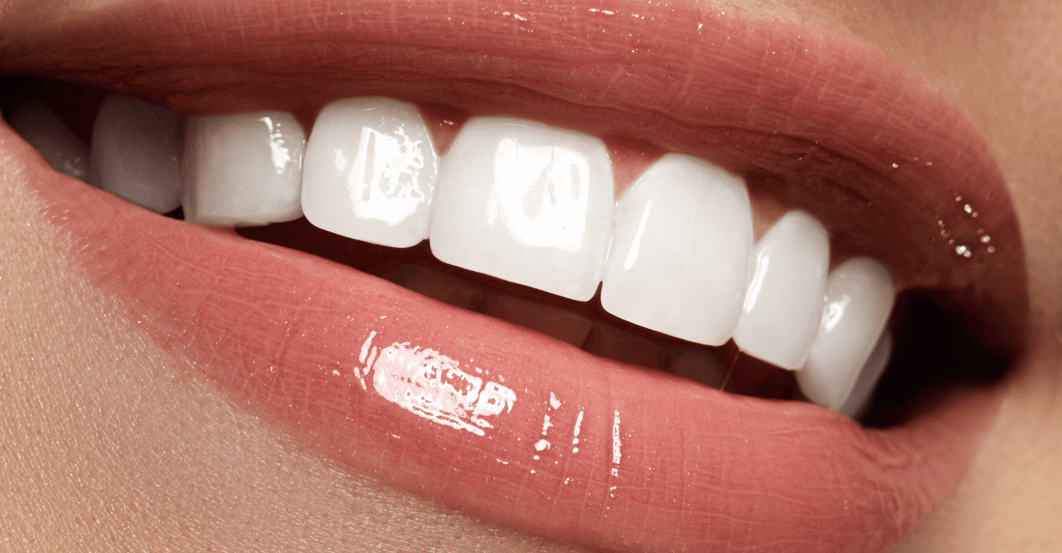 Implant Crowns Procedure