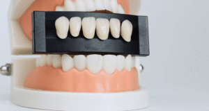 guide to dental veneers in nashville