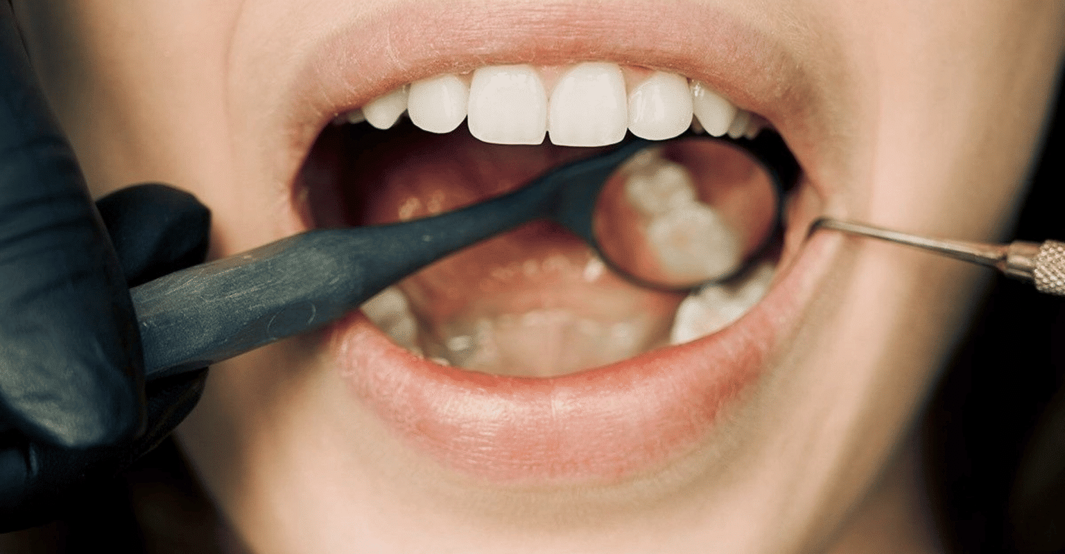 Extracción dental en Nashville