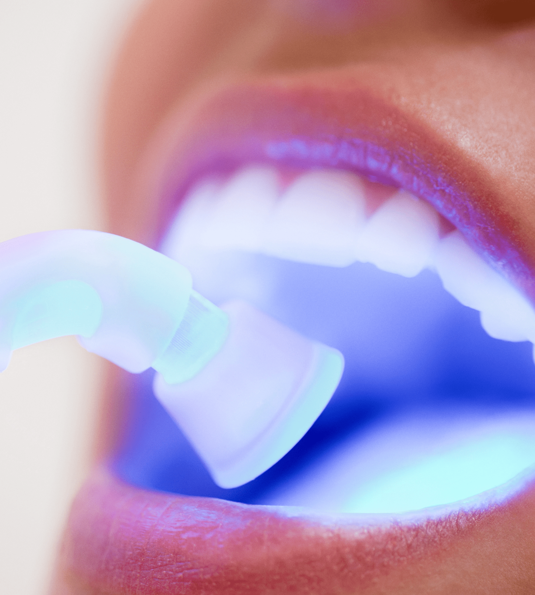 teeth whitening blog