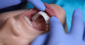 What Type of Dentist Does Root Canals