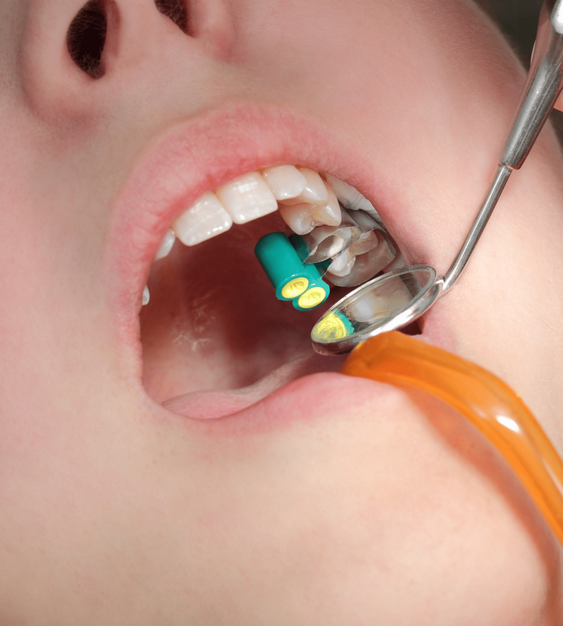 types of dental crowns in nashville blog