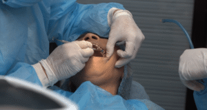 wisdom teeth removal cost without insurance