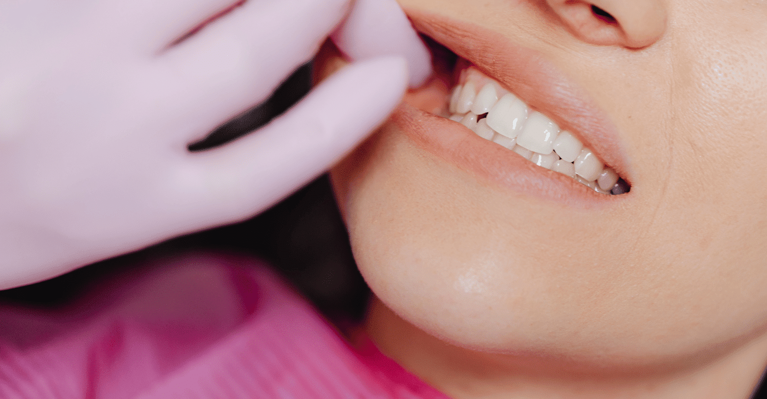 how to get rid of bad breath from wisdom teeth