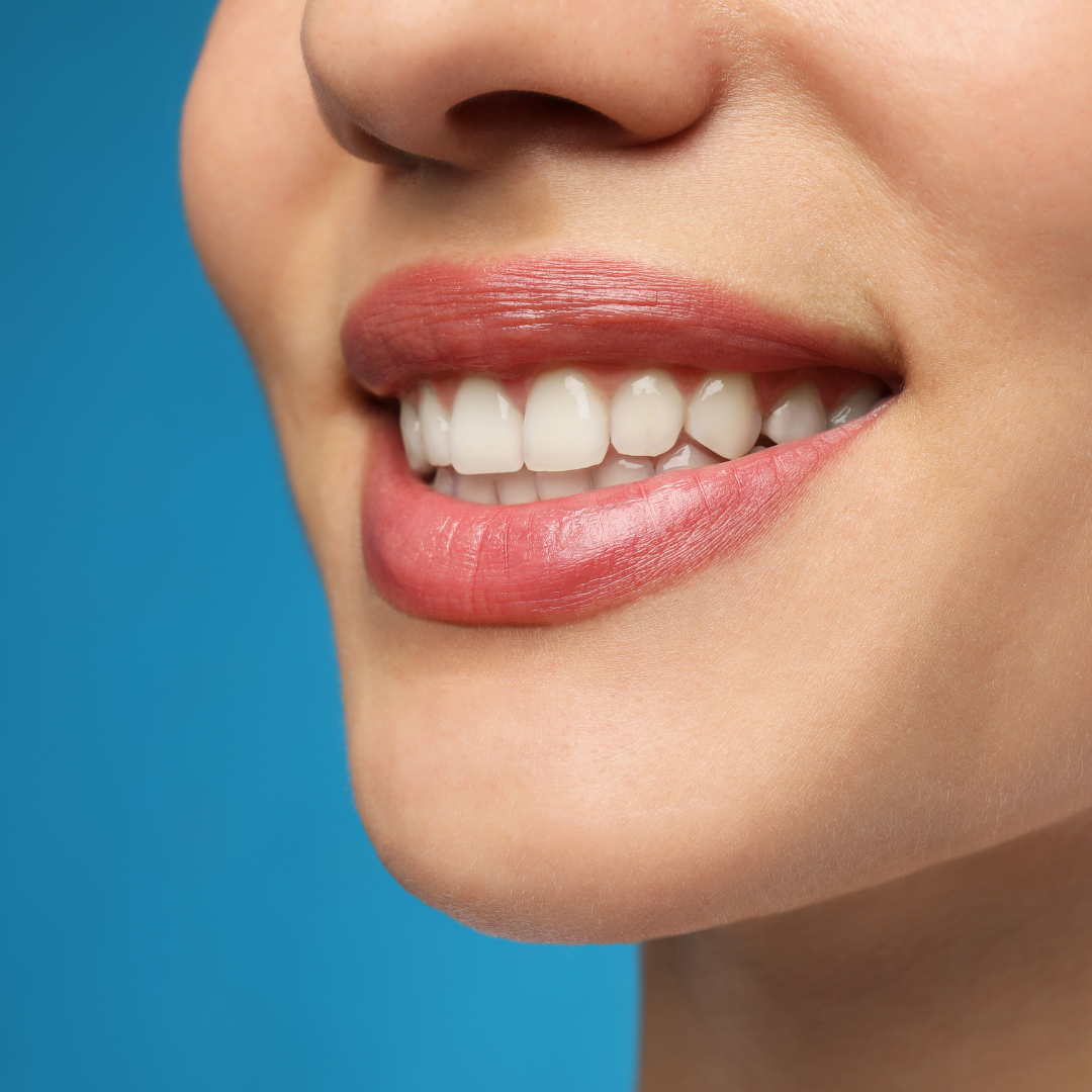 Cosmetic Dentistry in Nashville