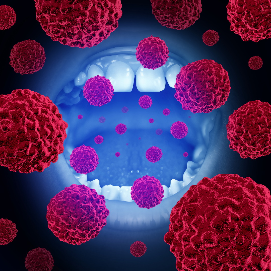 Oral Cancer Screening Nashville