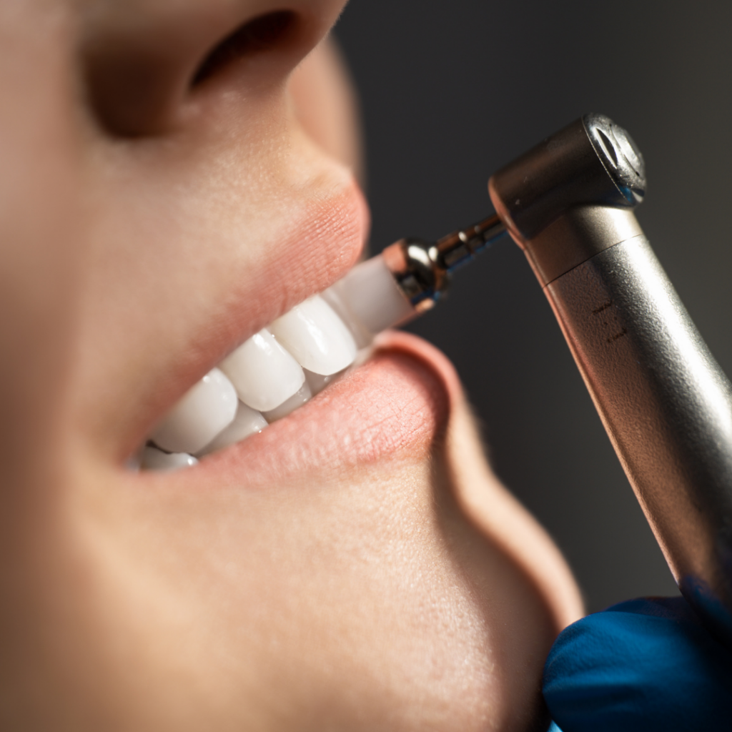 Teeth Whitening Nashville