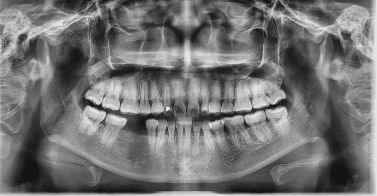 dental-x-rays-nashville