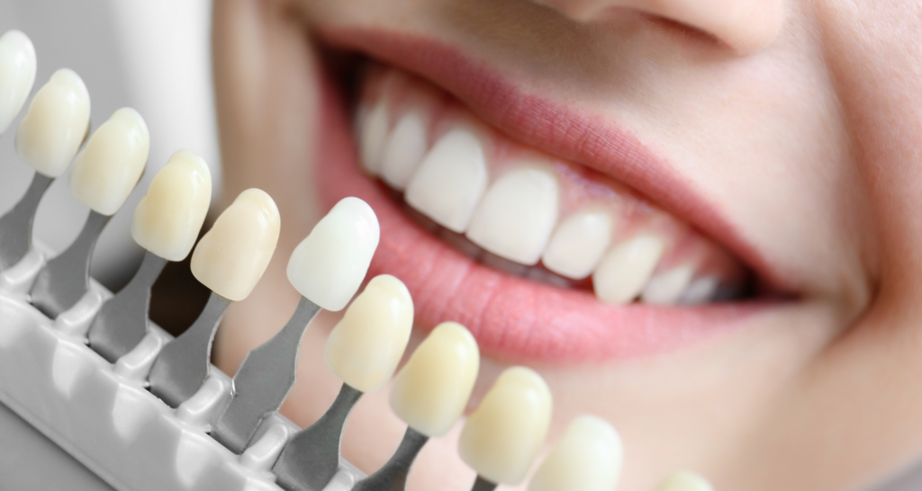 Hydrogen Peroxide Rinse vs. Whitening Strips