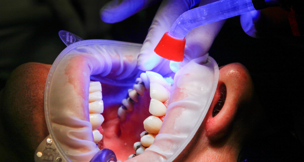How to Budget for Dental Work Without Insurance