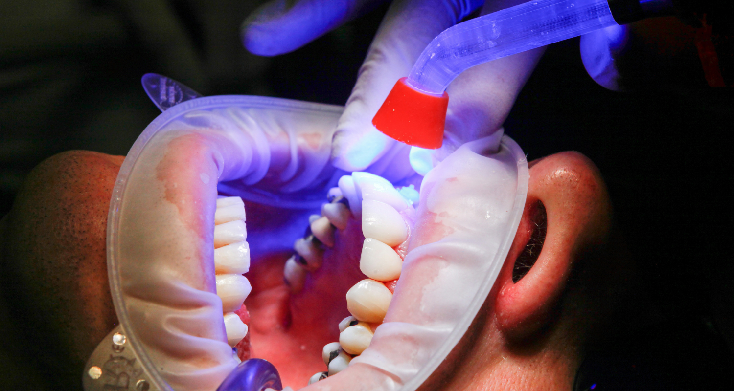 How to Budget for Dental Work Without Insurance