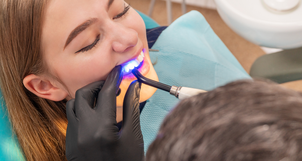 Teeth Bonding vs. Veneers in Nashville